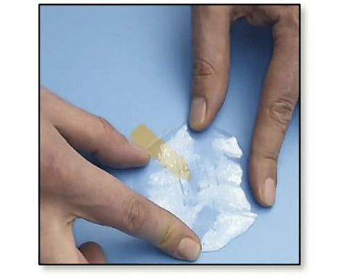 Aplikácia fixačnej náplasti na kožu