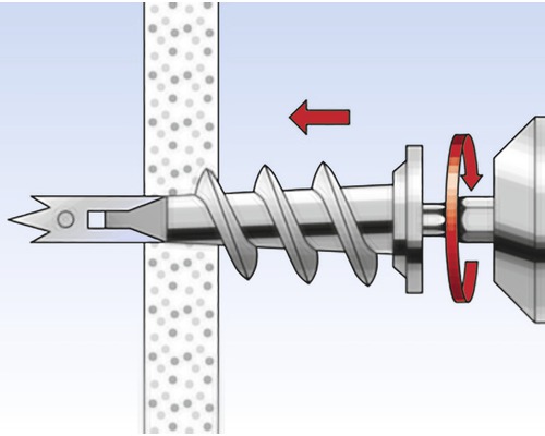 Ilustrácia hmoždinky upevnenej v stene